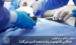 هنگامی که تومور در پشت معده کمین می‌کند!